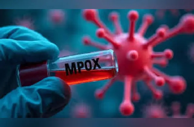 ಎಂಪಾಕ್ಸ್‌ ಸೋಂಕು: ಬೆಂಗಳೂರು ಏರ್‌ಪೋರ್ಟ್‌ನಲ್ಲಿ ಟೆಸ್ಟಿಂಗ್ ಕಡ್ಡಾಯ! - News Karnataka