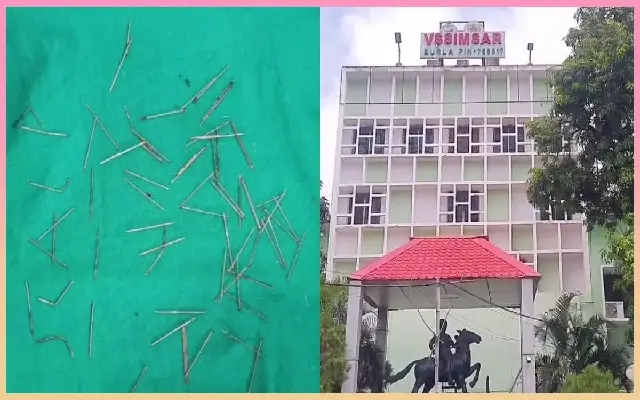 ಯುವತಿಯ ತಲೆ ಹೊಕ್ಕಿದ್ದ 70 ಸೂಜಿಗಳು : ಶಸ್ತ್ರಚಿಕಿತ್ಸೆ ನಡೆಸಿ ಹೊರತೆಗೆದ ವೈದ್ಯರು - News Karnataka
