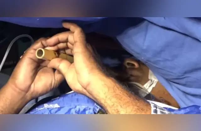 ರೋಗಿ ಕೊಳಲು ನುಡಿಸುವಾಗಲೇ ಮೆದುಳು ಶಸ್ತ್ರಚಿಕಿತ್ಸೆ!