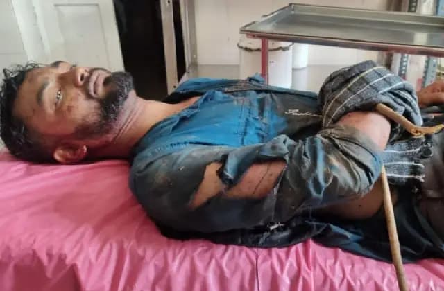 ಪುತ್ತೂರಿನಲ್ಲಿ ಸ್ಕೂಟರ್ ಸವಾರನ ಮೇಲೆ ಕಾಡು ಹಂದಿ ದಾಳಿ
