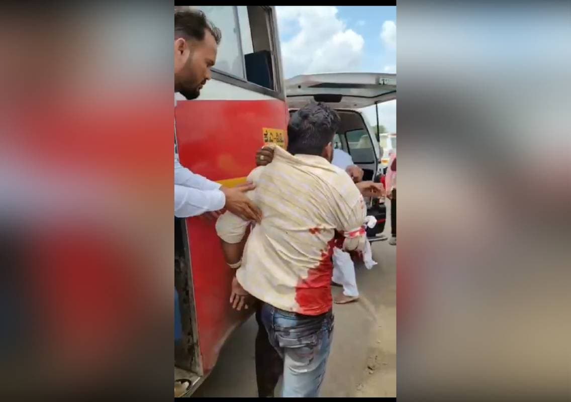 ಜೇವರ್ಗಿ: ಬಸ್ ಹಾಗೂ ಲಾರಿ ನಡುವೆ ಅಪಘಾತಕ್ಕೆ ಬಸ್‌ ಪ್ರಯಾಣಿಕನ ಕೈ ಕಟ್