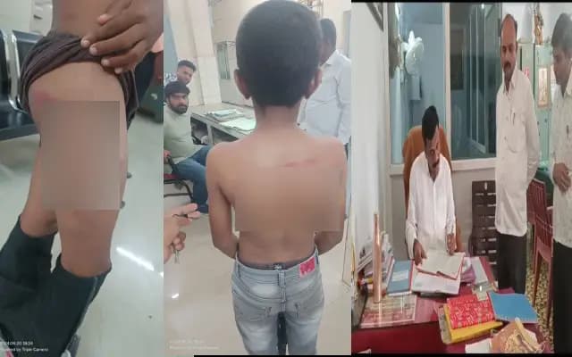 ಶಿಕ್ಷಕನಿಂದ ವಿದ್ಯಾರ್ಥಿಗೆ ಥಳಿತ : ಶಾಲೆಗೆ ಭೇಟಿ ನೀಡಿದ ಮಕ್ಕಳ ರಕ್ಷಣಾ ಆಯೋಗ