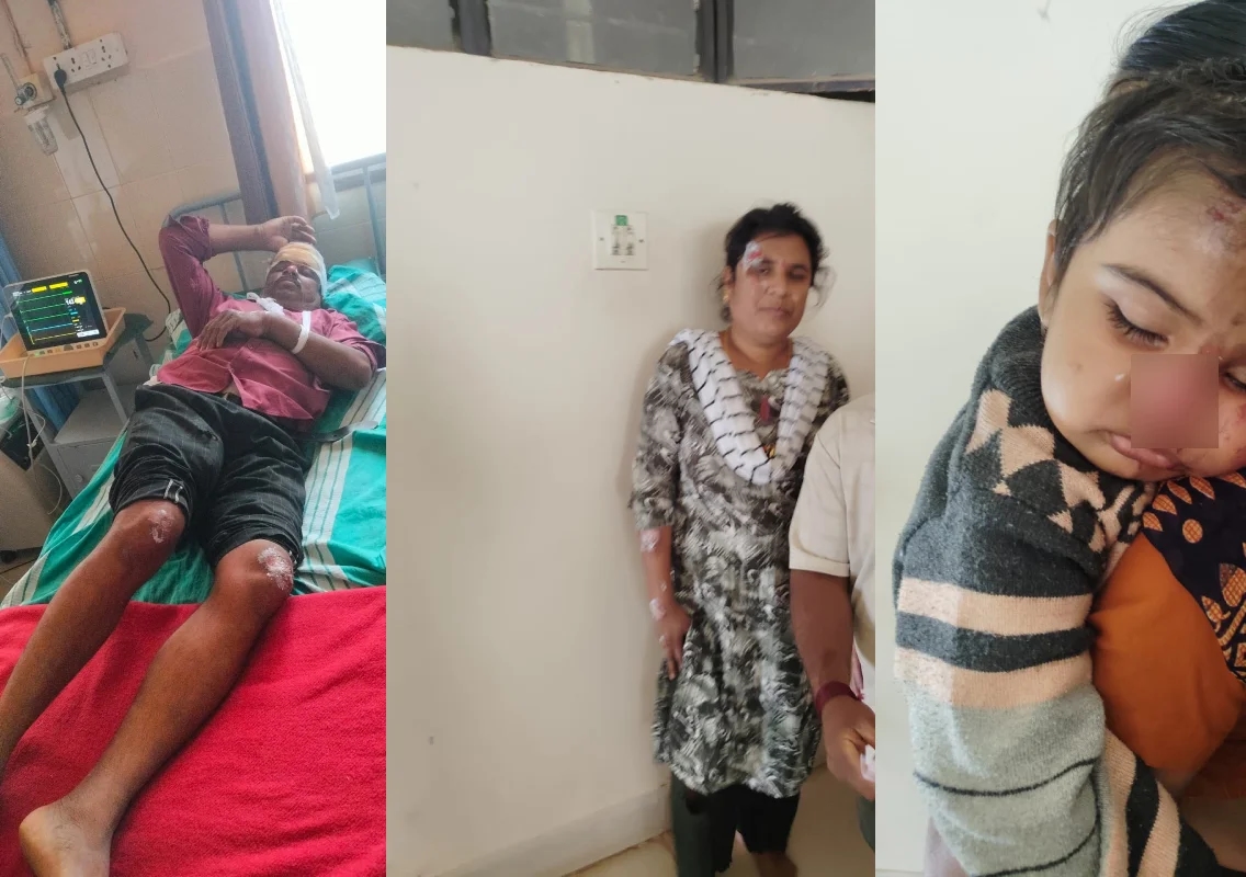 ಬೈಕ್ ನಲ್ಲಿ ಹೋಗುತ್ತಿದ್ದ ದಂಪತಿ ಮೇಲೆ ಚಿರತೆ ಅಟ್ಯಾಕ್, ಮಗು ಸೇರಿ ಮೂವರಿಗೆ ಗಂಭೀರ ಗಾಯ! - News Karnataka